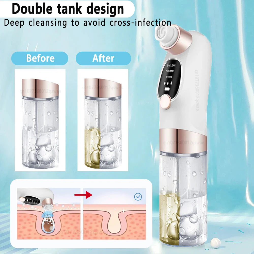 Electric Blackhead Remover Vacuum - Pore Face Cleaner